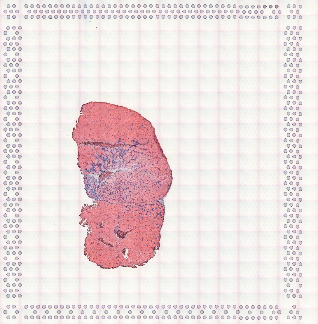 A cross section of mouse muscle is slightly off center to the lower left. In the middle of the tissue is the notexin injury site with leukocyte infiltration and fewer myofibers. The rest of the tissue section is tightly packed with myofibers.