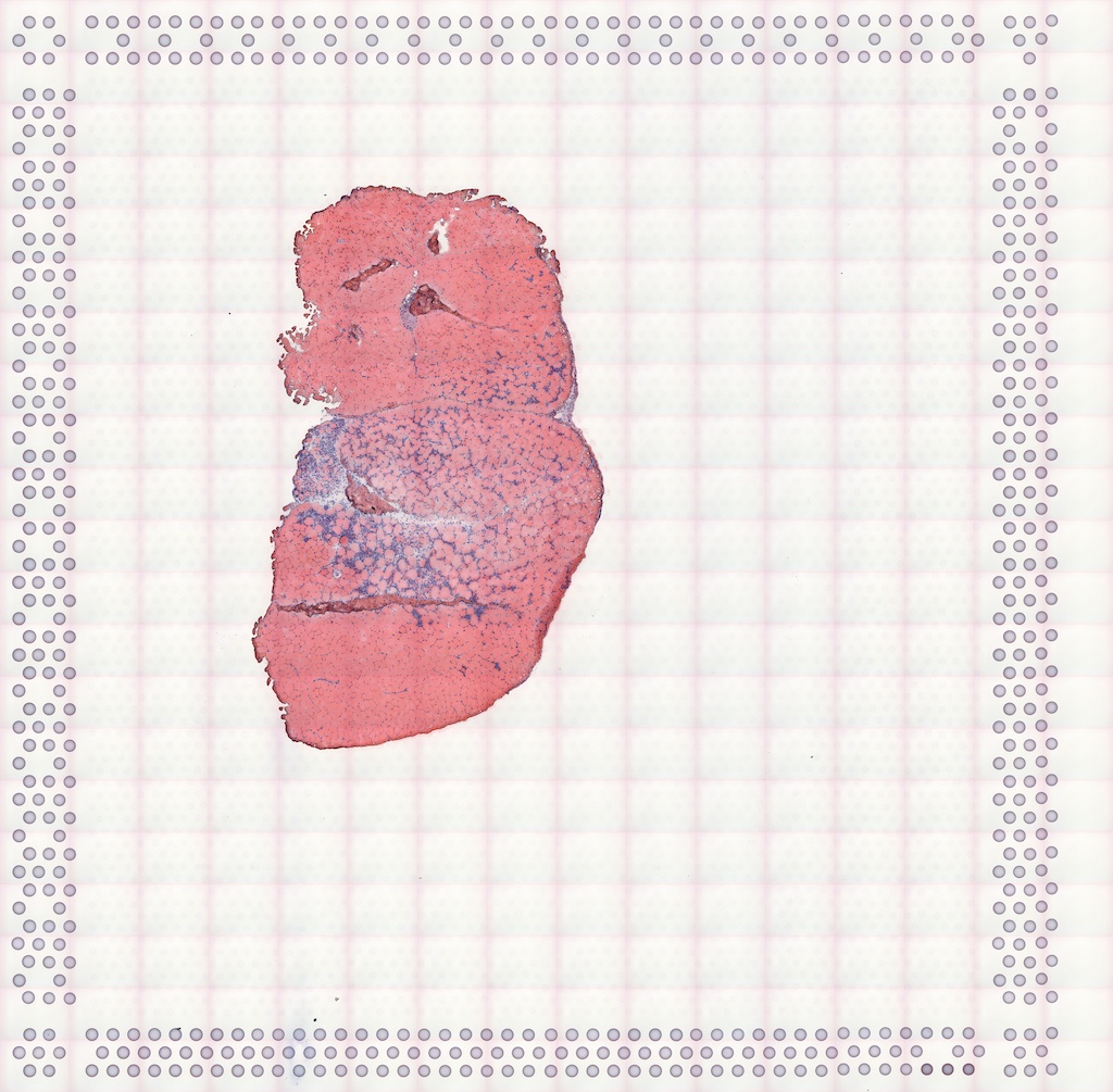 A cross section of mouse muscle is slightly off center to the lower left. In the middle of the tissue is the notexin injury site with leukocyte infiltration and fewer myofibers. The rest of the tissue section is tightly packed with myofibers.
